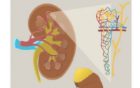 分析将肾功能受损与认知障碍联系起来