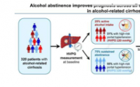研究发现即使在晚期肝硬化患者中戒酒也是必不可少的