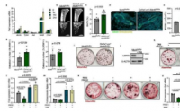 研究发现酶抑制促进骨形成并抑制骨转移的发展