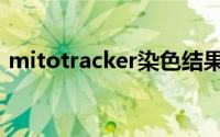 mitotracker染色结果分析（mitotracker）